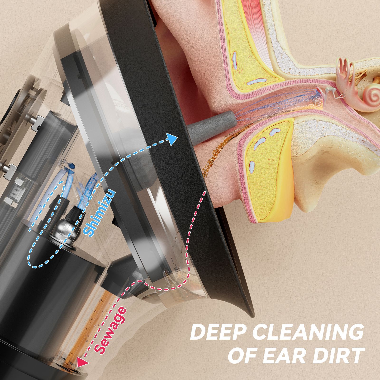 E80 Professional Electric Ear Irrigation And Ear Wax Removal Kit - Type-C Charging, 3 Pressure Levels, 2-In-1 230Ml Sewage &Amp; Shimizu Tank &Amp; 12 Specialized Nozzles(4Pcs 1-Hole Nozzles +4Pcs 3-Hole Nozzles + 4Pcs 5-Hole Nozzles) – Wonder Shop E80 Professional Electric Ear Irrigation And Ear Wax Removal Kit - Type-C Charging, 3 Pressure Levels, 2-In-1 230Ml Sewage &Amp; Shimizu Tank &Amp; 12 Specialized Nozzles(4Pcs 1-Hole Nozzles +4Pcs 3-Hole Nozzles + 4Pcs 5-Hole Nozzles) - Image 4